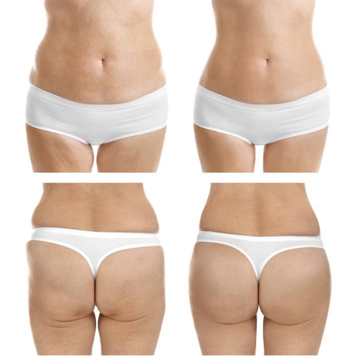 Truwave Ventre et fesses