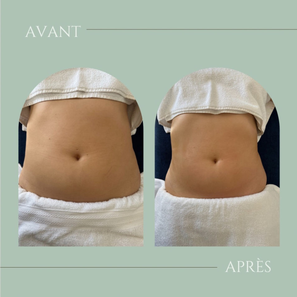 Résultats de clientes